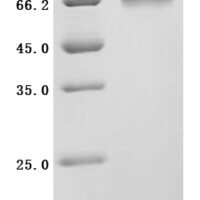 Mouse Atrial natriuretic peptide receptor 1 (Npr1), Partial Recombinant Protein - BioCrest Sci