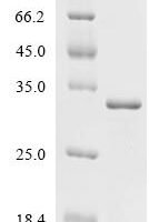 Rhizobium meliloti Chitooligosaccharide deacetylase (nodB) Recombinant Protein - BioCrest Sci