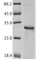 Human HLA class II histocompatibility antigen, DRB1-3 chain (HLA-DRB1), partial Recombinant Protein - BioCrest Sci