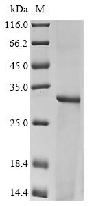 Human HLA class II histocompatibility antigen, DRB1-3 chain (HLA-DRB1), partial Recombinant Protein, Homo sapiens (Human), E.coli, N-terminal 6xHis-tagged, 31.1 kDa, purity >≥ 90% as determined by SDS-PAGE.