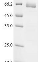 Human Neutrophil elastase (ELANE) Recombinant Protein, C-hFc1 - BioCrest Sci