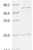Rotavirus A Non-structural glycoprotein 4, partial Recombinant Protein, C-His - BioCrest Sci