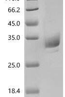 Human Angiopoietin-1 (ANGPT1), partial Recombinant Protein - BioCrest Sci