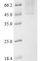 Human Sialidase-2 (NEU2) Recombinant Protein, C-His, aa 1–380, Yeast - BioCrest Sci