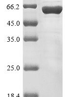 Rat Nuclear pore glycoprotein p62 (Nup62) Recombinant Protein, N-10His - BioCrest Sci