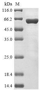 Rat Nuclear pore glycoprotein p62 (Nup62) Recombinant Protein, N-10His, Rattus norvegicus (Rat), E.coli, N-terminal 10xHis-tagged, 59.3 kDa, purity >≥ 85% as determined by SDS-PAGE.