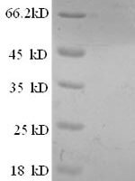 Human Prostate stem cell antigen (PSCA), partial Recombinant Protein - BioCrest Sci