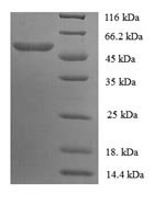 Mouse Carboxylesterase 1C (Ces1c), partial Recombinant Protein, N-GST - BioCrest Sci