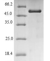 Pig Uricase (UOX) Recombinant Protein, N-His-SUMO - BioCrest Sci