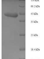Phytolacca dioica Ribosome-inactivating protein PD-L1/PD-L2 Recombinant Protein - BioCrest Sci