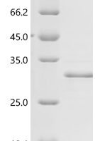 Human SAP30-binding protein (SAP30BP), partial Recombinant Protein - BioCrest Sci