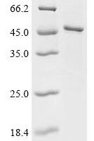 Human S-adenosylmethionine synthase isoform type-1 (MAT1A) Recombinant Protein, C-His - BioCrest Sci