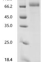 Human Follistatin (FST) Recombinant Protein - BioCrest Sci