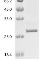 Human Tumor necrosis factor ligand superfamily member 13B (TNFSF13B), partial Recombinant Protein - BioCrest Sci