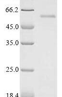 Human immunodeficiency virus type 1 group M subtype B Virion infectivity factor (vif) Recombinant Protein - BioCrest Sci