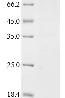 Rat CD44 antigen (CD44) (R578A), partial Recombinant Protein - BioCrest Sci