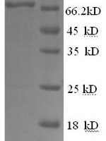 Human Glucose-6-phosphate isomerase (GPI), partial Recombinant Protein - BioCrest Sci