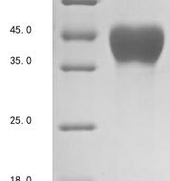 Human Mesothelin (MSLN), partial Recombinant Protein - BioCrest Sci