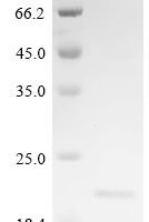 Human Proprotein convertase subtilisin/kexin type 6 (PCSK6), partial Recombinant Protein - BioCrest Sci