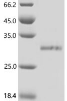 Human Myelin proteolipid protein (PLP1), partial Recombinant Protein - BioCrest Sci
