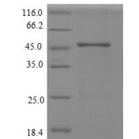 Human Replication protein A 32 kDa subunit (RPA2), partial Recombinant Protein, N-GST - BioCrest Sci