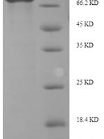 Human Interferon-induced, double-stranded RNA-activated protein kinase (EIF2AK2) Recombinant Protein, N-His-SUMO - BioCrest Sci
