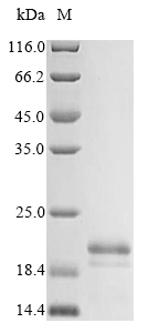 Bovine viral diarrhea virus Genome polyprotein, partial Recombinant Protein, Bovine viral diarrhea virus (strain SD-1) (BVDV) (Mucosal disease virus), Yeast, N-terminal 6xHis-tagged, 20.4 kDa, purity >≥ 85% as determined by SDS-PAGE.