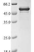 Bat coronavirus 133/2005 Nucleoprotein (N) Recombinant Protein, N-10His/C-Myc - BioCrest Sci