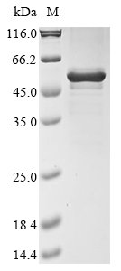 Bat coronavirus 133/2005 Nucleoprotein (N) Recombinant Protein, N-10His/C-Myc, Bat coronavirus 133/2005 (BtCoV) (BtCoV/133/2005), Baculovirus, N-terminal 10xHis-tagged and C-terminal Myc-tagged, 49.9 kDa, purity >≥ 85% as determined by SDS-PAGE.