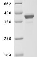 Human Inositol 1,4,5-trisphosphate receptor-interacting protein-like 1 (ITPRIPL1), partial Recombinant Protein - BioCrest Sci