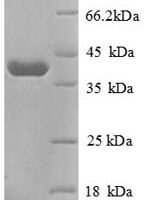 Human Golgi membrane protein 1 (GOLM1), partial Recombinant Protein, N-GST - BioCrest Sci