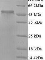 Human Protein ERGIC-53-like (LMAN1L) Recombinant Protein, N-His - BioCrest Sci