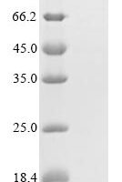 Mouse Integrin alpha-X (Itgax), partial Recombinant Protein, N-MBP/C-His - BioCrest Sci