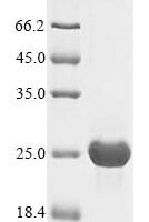 Human cytomegalovirus Uncharacterized protein UL128 (UL128) Recombinant Protein, N-His, aa 1–171, strain AD169 - BioCrest Sci