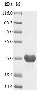 Human cytomegalovirus Uncharacterized protein UL128 (UL128) Recombinant Protein, N-His, aa 1–171, strain AD169, Human cytomegalovirus (strain AD169) (HHV-5) (Human herpesvirus 5), E.coli, N-terminal 6xHis-tagged, 23.7 kDa, purity >≥ 85% as determined by SDS-PAGE.
