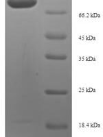Human Proliferation marker protein Ki-67 (MKI67), partial Recombinant Protein, N-His-SUMO, aa 2720–3256 - BioCrest Sci