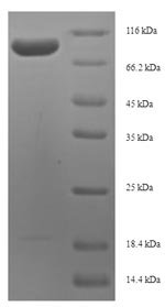 Human Proliferation marker protein Ki-67 (MKI67), partial Recombinant Protein, N-His-SUMO, aa 2720–3256, Homo sapiens (Human), E.coli, N-terminal 6xHis-SUMO-tagged, 72.1 kDa, purity >≥ 90% as determined by SDS-PAGE.