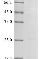 Mouse Scrapie-responsive protein 1 (Scrg1) Recombinant Protein, N-His - BioCrest Sci