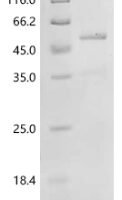 Human Caspase-2 (CASP2) Recombinant Protein - BioCrest Sci