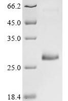 Anisakis simplex Major allergen Ani s 1 Recombinant Protein - BioCrest Sci