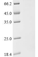Penaeus monodon Hemocyanin (HcVn) Recombinant Protein - BioCrest Sci