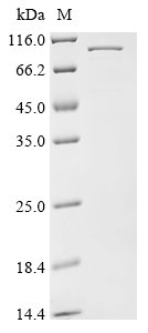Penaeus monodon Hemocyanin (HcVn) Recombinant Protein, Penaeus monodon (Giant tiger prawn), E.coli, N-terminal 10xHis-tagged and C-terminal Myc-tagged, 83.5 kDa, purity >≥ 85% as determined by SDS-PAGE.