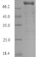 Human Serine/threonine-protein kinase PAK 1 (PAK1) Recombinant Protein - BioCrest Sci