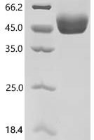 Mouse T-cell surface glycoprotein CD5 (Cd5), partial Recombinant Protein - BioCrest Sci