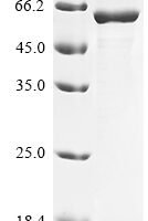 Human Cathepsin D (CTSD), partial Recombinant Protein, N-GST - BioCrest Sci