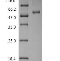 Rat Plasminogen activator inhibitor 2 type A (Serpinb2) Recombinant Protein, N-His - BioCrest Sci