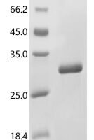 Bovine Prolactin (PRL) Recombinant Protein, C-His, aa 31–229, E.coli - BioCrest Sci