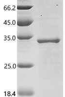 Human Calcium-activated chloride channel regulator 1 (CLCA1), partial Recombinant Protein, C-His, aa 696–914 - BioCrest Sci