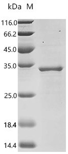 Human Calcium-activated chloride channel regulator 1 (CLCA1), partial Recombinant Protein, C-His, aa 696–914, Homo sapiens (Human), E.coli, C-terminal 6xHis-tagged, 31.2 kDa, purity >≥ 85% as determined by SDS-PAGE.