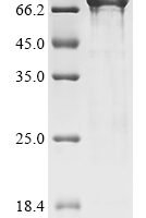 Pandalus borealis Northern shrimp nuclease (nuc1), partial Recombinant Protein - BioCrest Sci